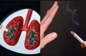 Bahaya Merokok: Risiko Serangan Jantung dan Stroke Meningkat 2-5 Kali Lipat