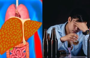 Bahaya Minuman Keras Bagi Kesehatan Tubuh dan Mental