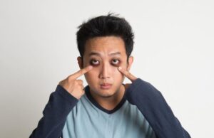 Tips Menghilangkan Mata Panda